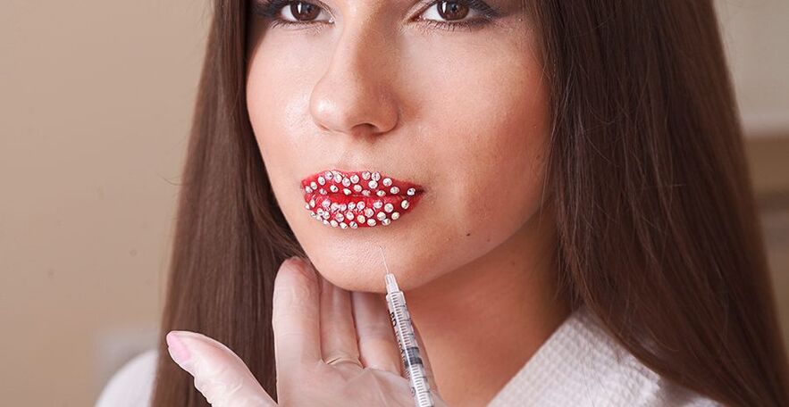 Augmentation et correction esthétique des lèvres grâce à des produits de comblement. 